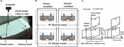 Relationship Between Body-Specific Attention to a Paretic Limb and Real-World Arm Use in Stroke Patients: A Longitudinal Study